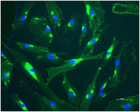 Assessment Of The Purity Of Fibroblasts From A Cultured Skin