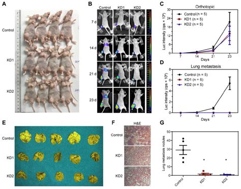 Silencing KDM6B Inhibited Lung Metastasis Of OS In Nude Mice Models