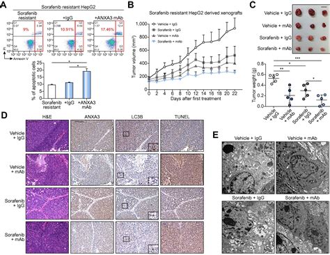 Efficacy Of Annexin A Blockade In Sensitizing Hepatocellular Carcinoma