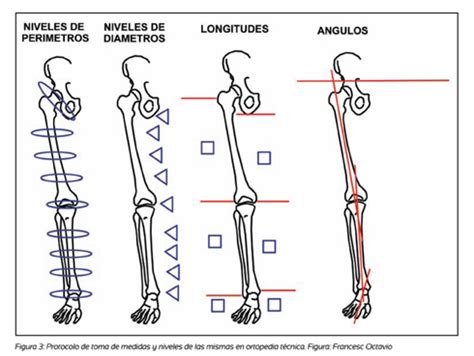 Antropometría y Toma de Medidas en Ortopedia Técnica Miembros