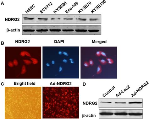 Up Regulation Of Ndrg2 Expression By Ad Ndrg2 In Eca 109 Cells A Heec Download Scientific