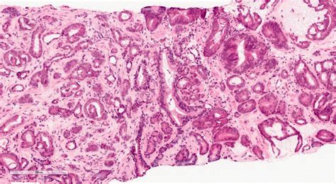 Prostate Gland Histology