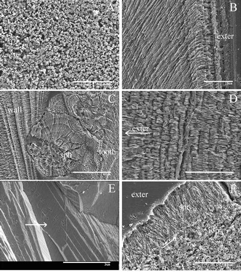 Figure 6 From Unique Mg Calcite Skeletal Ultrastructure In The Tube Of