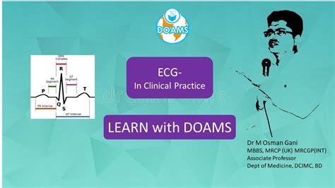 Ecg Ischemic Heart Disease English Youtube