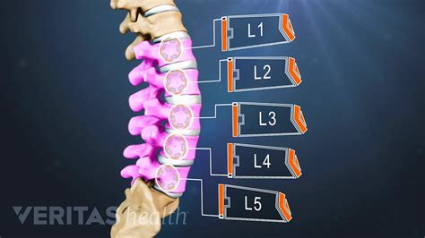 Spine Vertebrae Out Of Place