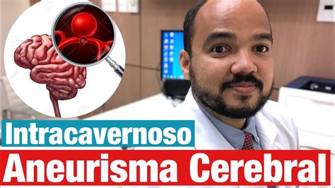 Aneurisma Cerebral Segmento Intracavernoso Da Car Tida Interna Youtube