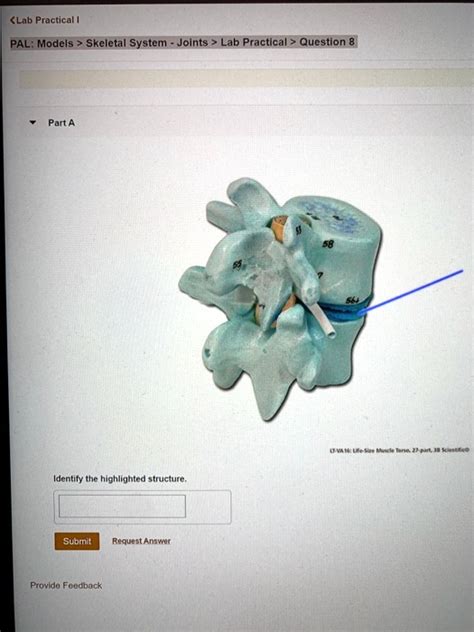 SOLVED Lab Practical PAL Models Skeletal System Joints Lab