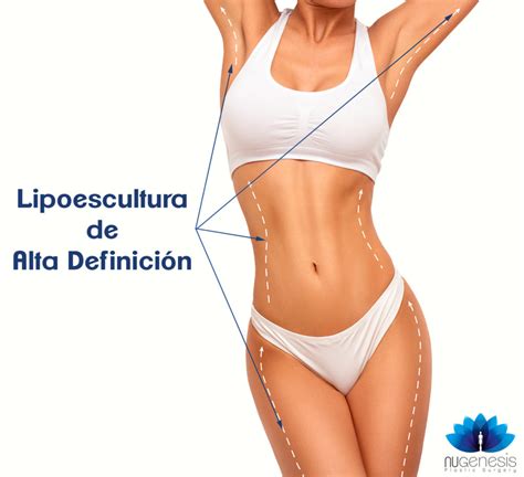 Lipoescultura De Alta Definici N Nugenesis Plastic Surgery Clinica