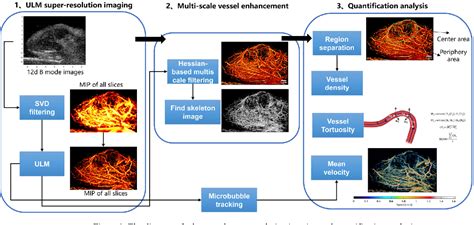 Figure From Ultrasound Super Resolution Imaging Enables