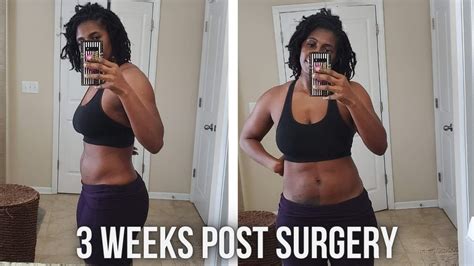 3 Weeks Post Hysterectomy Surgery Finally Feeling Like Myself Youtube