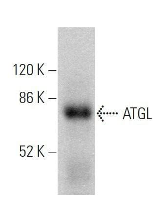 Anti Atgl Antibody F Scbt Santa Cruz Biotechnology