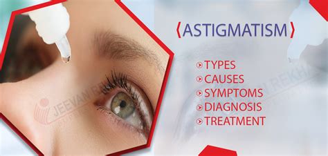 Astigmatism Types Causes Symptoms Diagnosis And Treatment