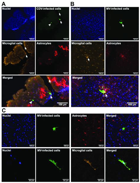 Microglia But Not Astrocytes In Brain Slice Cultures Were Susceptible