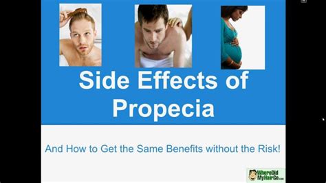 Propecia Side Effects And A 100 Safe Herbal Alternative Man Health