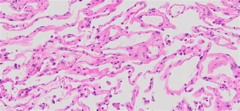 Human Lung Tissue Normal Ffpe Sections