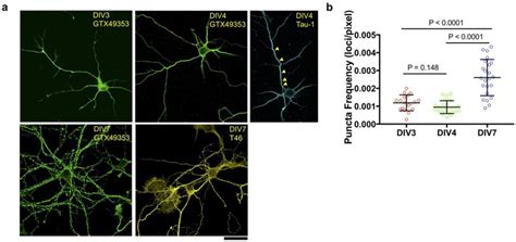 Developmental Regulation Of Tau Localization In Cultured Neurons A