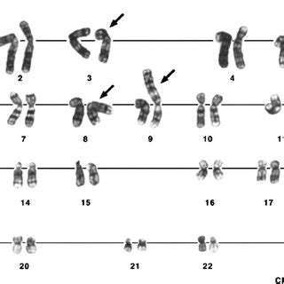 Karyotype of the benzo[ a ]pyrene-transformed MCF-10A cell line 1.3.3 ...