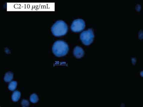 Hoechst staining. Nuclear damage was analysed by Hoechst stain. Control ...