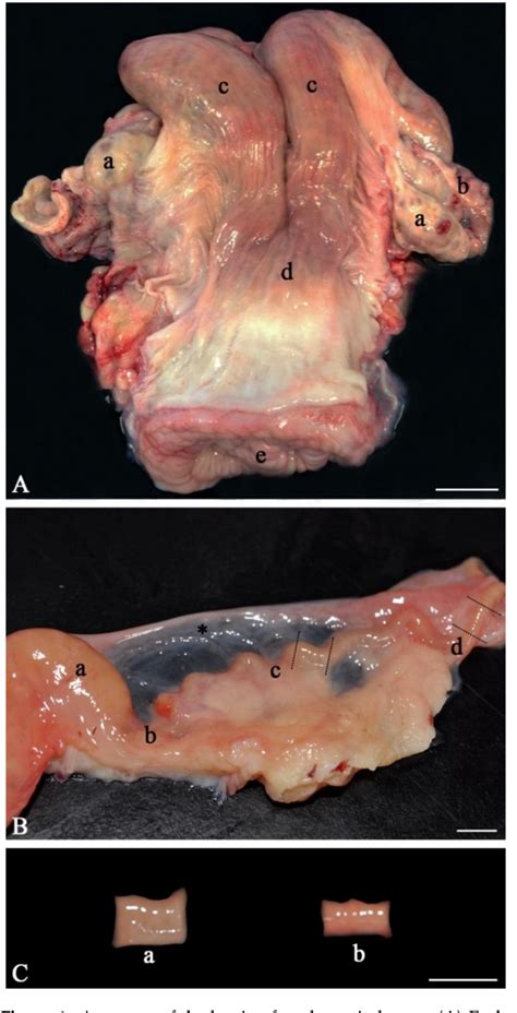 Figure 1 From Assessment Of Sperm Binding Capacity In The Tubal