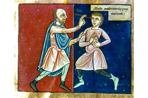 Kill Or Cure 10 Medieval Medical Practices And Their Effectiveness