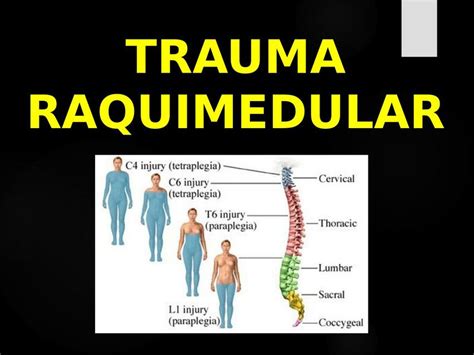 Trauma Raquimedular Digital Medicina Udocz