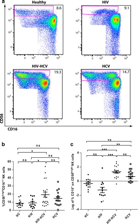 Increased Cd Bright Cd Nk Cells In Hiv Hcv Co Infection A