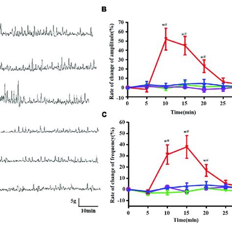 Effect Of Bilateral Subdiaphragmatic Vagotomy On Orexin A Induced