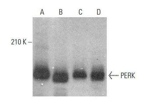 PERK抗体 B 5 SCBT Santa Cruz Biotechnology