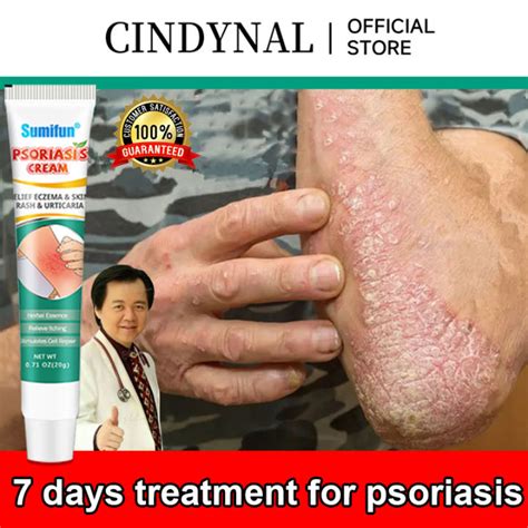 [cindynal] Riginal And Effective Eczema Treatment Herbal Antibacterial