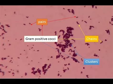 Gram Positive Cocci Under Microscope Gram Positive Bacteria GPC In