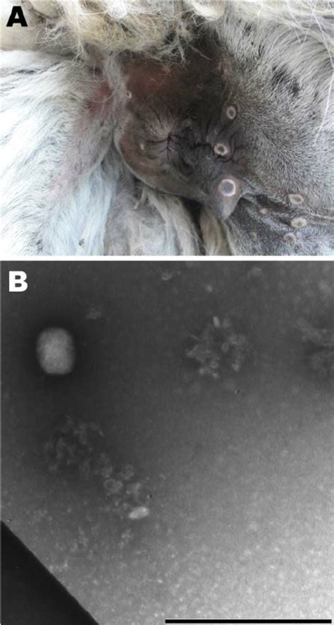 A Skin Lesions Showing A Crater Morphologic Appearance Typical Of