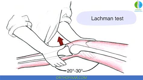 Lachman Test