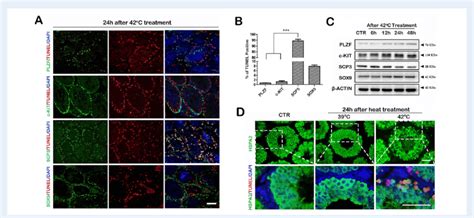 Co Staining Of Tunel And Testicular Cell Markers Or Heat Shock Protein