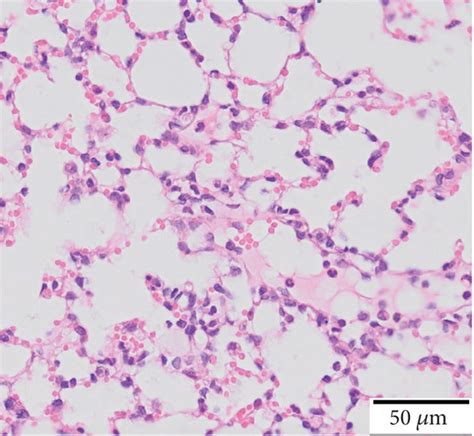 The Effects Of EFBS On Changes To Lung Histopathology Ae And Total