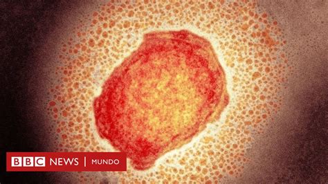 Qué es la viruela de los monos la rara infección que descubrieron en