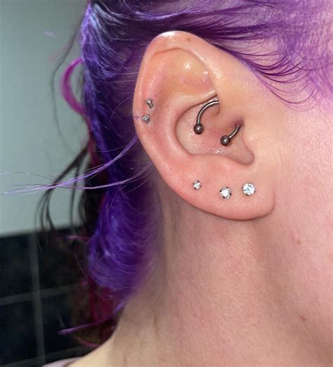 3 Month Old Daith Pierced With Titanium Jewellery It Has Recently