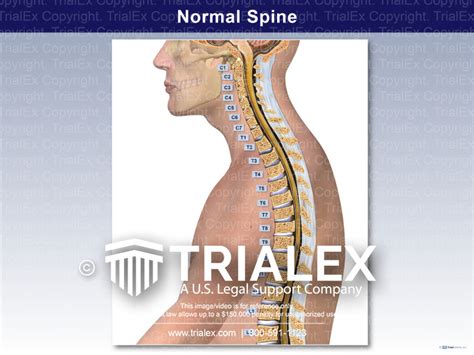 Normal Spine Trialquest Inc