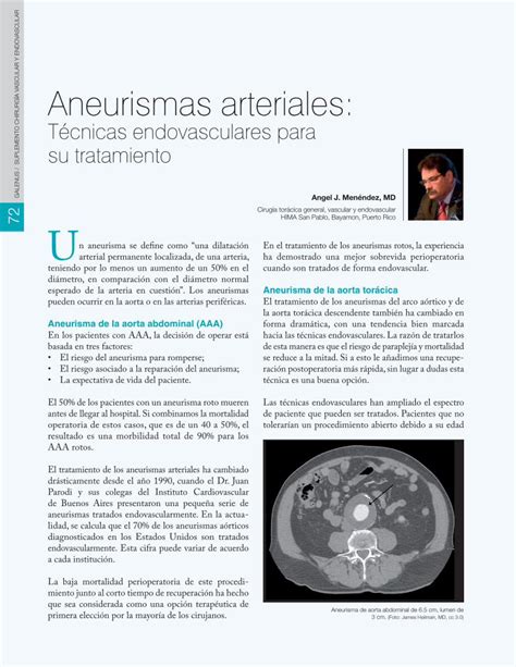 Pdf T Cnicas Endovasculares Para Su Tratamiento Aneurisma De Aorta