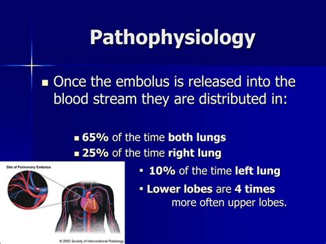 Ppt Dvt Prophylaxis And Pulmonary Embolism Powerpoint Presentation Free Download Id 3622002