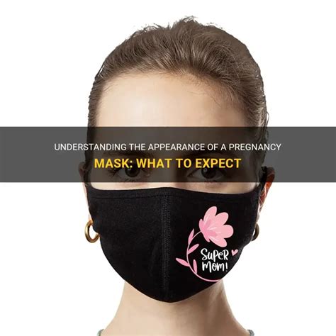 Understanding The Appearance Of A Pregnancy Mask: What To Expect ...