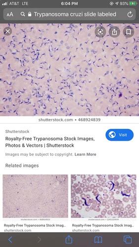 Protozoa Flashcards Quizlet