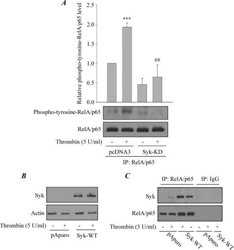 A Effect Of Kinase Defective Mutant Of Syk On Thrombin Induced