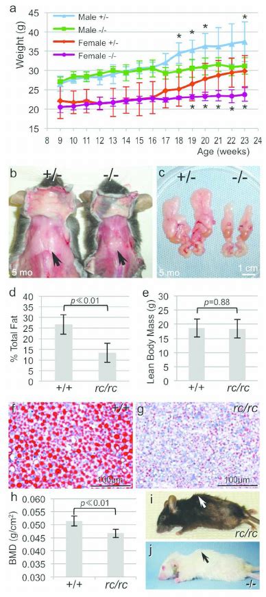 Reduced Adiposity And Bone Mineral Density In The Mpzl3 And Rc Rc