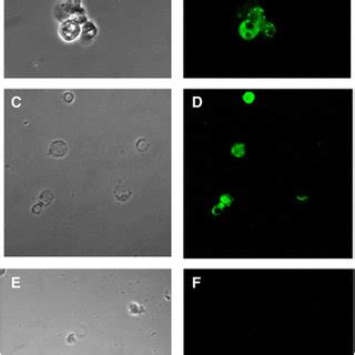 Abl kinase domain T315I point mutation detection analysis by PNA ...