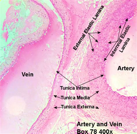 Blood Vessel Histology Histology The Best Porn Website