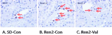 Tunel Staining In Proximal Tubule Cells Ptcs Of Transgenic