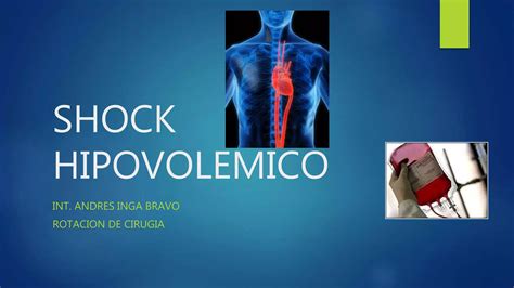 Shock Hipovolemico Ppt