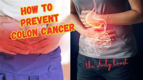 How To Prevent Colon Cancer What You Need To Know Cancer Coloncancer