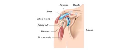 Shoulder Bursitis - Overview - Nonsurgical Options - Orlando Hand Surgery Associates