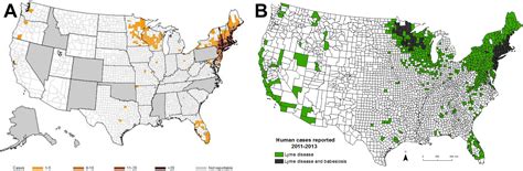 Human Babesiosis Infectious Disease Clinics